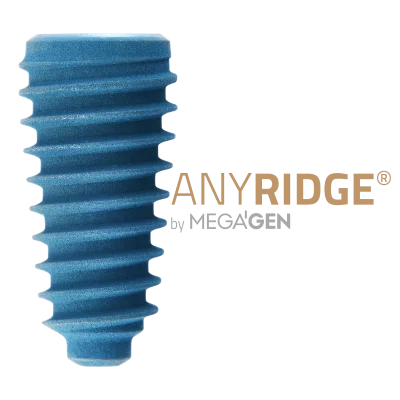 anyridge