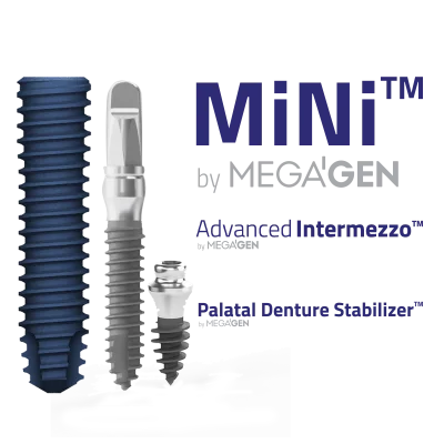 mini-intermezzo-palatal