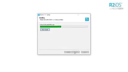 اسکنر داخل دهانی R2ios